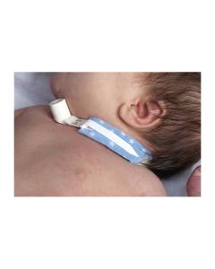 Dale trachéotomie tube holder nouveau-né/bébé 242